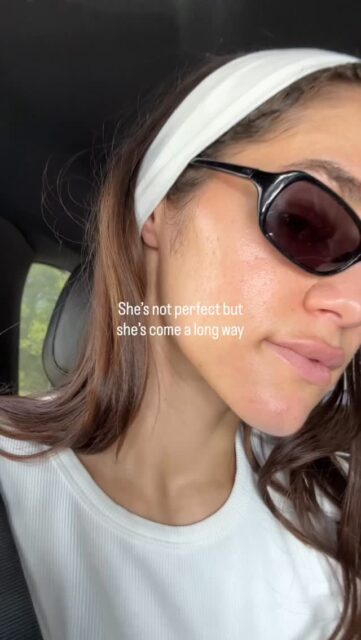 2026 and we’re finally getting it 🤞 #skincarejourney #acneproneskin #skinfood